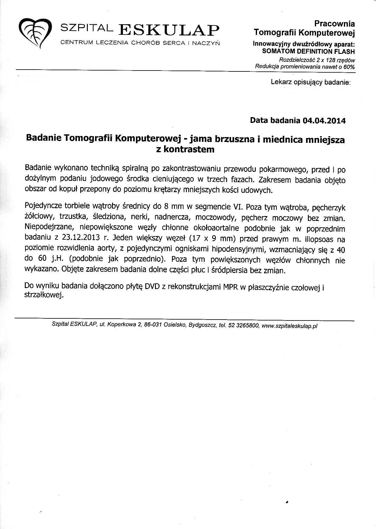 TK 04042014 Jama Brzuszna i miednica mniejsza1.jpg