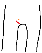 blizna.PNG